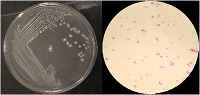 Plant Growth-Promoting Activity of Bacillus sp. PG-8 Isolated From Fermented Panchagavya and Its Effect on the Growth of Arachis hypogea